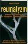 Reumatyzm