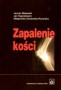 Zapalenie kości